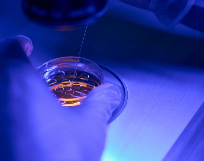 Επιλογή εμβρύων με time-lapse και τεχνητή νοημοσύνη